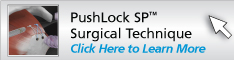 PushLock SP Surgical Technique