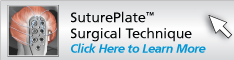 SuturePlate Surgical Technique